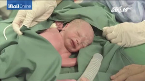 Em bé đầu tiên ở Mỹ ra đời từ người mẹ được cấy ghép tử cung