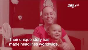 Chuyện lạ: Cặp song sinh không cùng cha, chẳng cùng mẹ