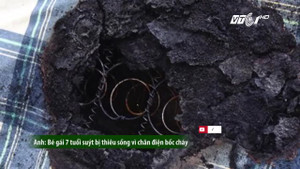 Hàng loạt thảm kịch đau lòng do thiết bị sưởi ấm mùa đông