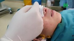 Dùng chỉ vĩnh viễn nâng mũi làm đẹp, cô gái hoại tử, suýt thủng mũi