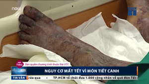 Ăn nem chạo sống, tiết canh lợn coi chừng mất Tết