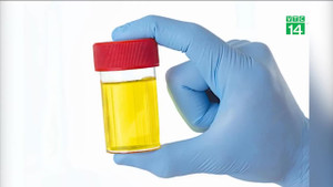 Nước tiểu có thể cho biết khi nào qua đời