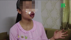 Cô gái biến dạng mặt vì làm đẹp: Diễn biến mới nhất