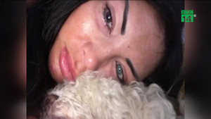 Tiêm silicone để đổi màu mắt, người mẫu gần như bị mù