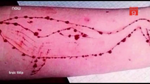 Trò chơi nguy hiểm 'Cá voi xanh' xuất hiện tại Tiền Giang