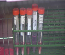 Vì sao cúm A/H1N1 lây lan nhanh ở các tỉnh phía Nam?