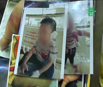 Nghi vấn bé trai 4 tuổi ở Bình Dương bị cha dượng bạo hành