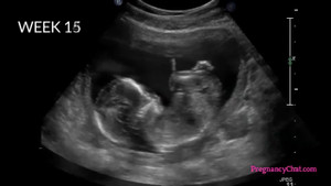 Tiến trình thai nhi lớn lên từ khi trứng gặp tinh trùng