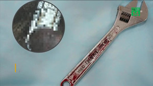 Chàng trai 19 tuổi bị mắc kẹt 'cậu nhỏ' trong mỏ lết: Bác sĩ đưa lời khuyên