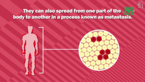 Ghép tạng hiến từ một phụ nữ, bốn người bị lây ung thư