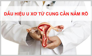 Dấu hiệu u xơ tử cung mà các chị em nhất định phải nắm rõ
