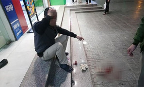 Ngồi dưới sân chung cư Linh Đàm, người đàn ông bị đá rơi vỡ đầu