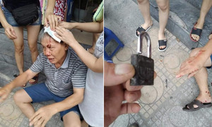 Đi bộ dưới sân chung cư, cụ ông bị ổ khóa rơi trúng đầu