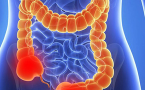 6 dấu hiệu cho thấy đại tràng của bạn đang có vấn đề