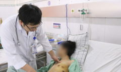 Tập tành hút thuốc lá sớm, nam thanh niên 23 tuổi nhập viện suýt chết 