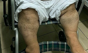 Việt Nam lần đầu sửa tim cho người lùn