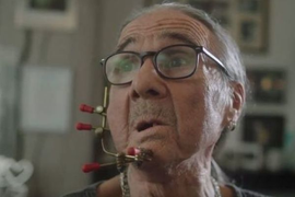 Người đàn ông bị ung thư lưỡi sau 54 năm hút thuốc