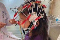 Bác sĩ kê nhầm thuốc động kinh để trị cảm lạnh và sốt, bé gái 6 tuổi bị mù tạm thời