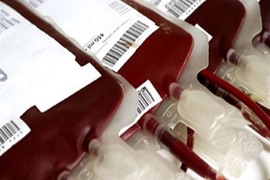 Mắc hội chứng lạ, người phụ nữ sống nhờ máu nam giới 