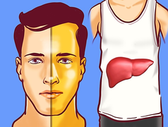 Những dấu hiệu cảnh báo gan bị tổn thương, cần đi khám bác sĩ ngay