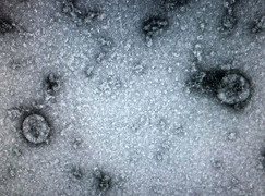 Việt Nam nuôi cấy thành công virus corona mới