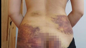 Bộ LĐTB & XH chỉ đạo xử lý nghiêm kẻ bạo hành vợ ở Tây Ninh