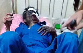 Xe chở xăng bốc cháy, tài xế bén lửa, bị hất văng ra xa