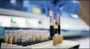 Người bị sốt, ho, khó thở có được làm xét nghiệm Covid-19?