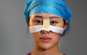 Những vết hằn trên khuôn mặt bác sĩ ở tâm dịch Covid-19