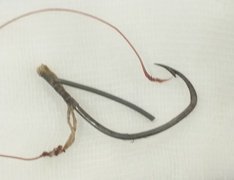 Tai nạn hi hữu: Bị lưỡi câu móc mắt khi câu cá