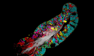 Hình ảnh kinh ngạc cho thấy vi khuẩn phân chia 'lãnh thổ' trong lưỡi người