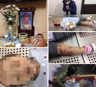 Bé 3 tuổi chết nghi do bố mẹ bạo hành: Chủ tịch Hà Nội yêu cầu khẩn trương xử lý