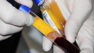 Việt Nam nghiên cứu dùng huyết tương của người khỏi bệnh trị virus corona