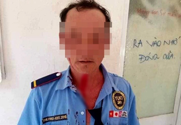 Khởi tố kẻ đánh bảo vệ khi bị nhắc đeo khẩu trang phòng COVID-19