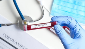 Vì sao bệnh nhân COVID-19 có thể dương tính lại sau 2 lần âm tính?