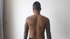 Nghi vấn đàn em Đường Dương truy sát nam thanh niên lúc nửa đêm rồi vứt xuống hố