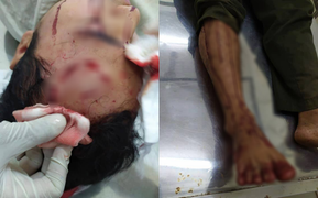 Đang ở trụ sở, kiểm lâm viên bị 10 tên côn đồ xông vào đánh trọng thương