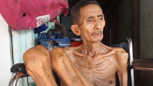 Video: Tìm thấy người đàn ông da bọc xương gây xúc động cộng đồng mạng