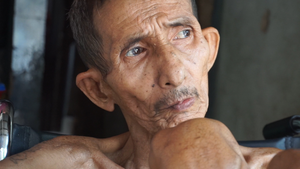 Cộng đồng thương xót người đàn ông da bọc xương sống trong nhà 7m2 