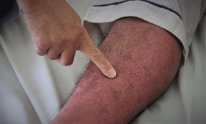 TP.HCM ghi nhận 6 ổ dịch sốt xuất huyết bùng phát