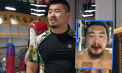 Từ Hiểu Đông gây xôn xao với hình ảnh bị đánh chảy máu miệng