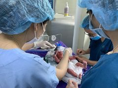 Mẹ chuyển dạ khi thai nhi 23 tuần tuổi, cặp song sinh chào đời chỉ nặng 600g