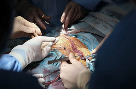 Vì sao bệnh nhân 91 phi công người Anh không thể ghép phổi từ người cho sống?