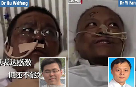 Trái chiều số phận 2 bác sỹ Vũ Hán cùng bị đổi màu da vì COVID-19