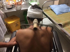 Kinh hãi con trai bổ bồ cào vào bố