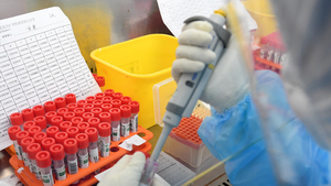 Virus SARS-CoV-2 có thể xuất hiện ở Tây Ban Nha từ tháng 3/2019