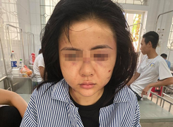 Cô gái bị thương tích 2% có được yêu cầu khởi tố vụ án hình sự?