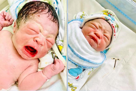 Em bé chào đời với vòng tránh thai, dân mạng đua nhau kể chuyện ‘vỡ kế hoạch’