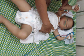 Bé trai 19 tháng tuổi bị bỏ quên 3 tiếng trên ô tô ở Vĩnh Phúc được xuất viện