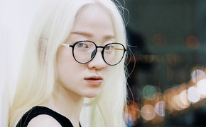 Cô gái bạch tạng Hà Nội bỗng nổi tiếng khắp cộng đồng mạng